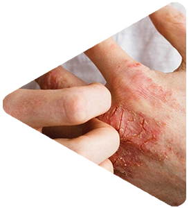 Archana hospital service for Dermatology